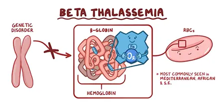 بتا تالاسمی, ارث بردن بتا تالاسمی, انواع بتا تالاسمی