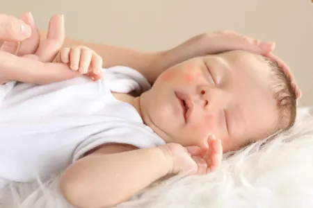 تغذیه مناسب برای پیشگیری از بیماری نوزاد