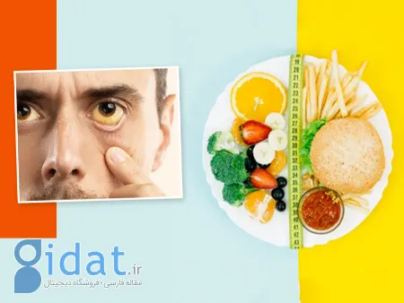 رژیم غذایی بیلی‌روبین بالا, یرقان و تغذیه