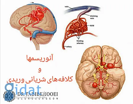 جراحی مغز و اعصاب,جراح مغز و اعصاب در ایران