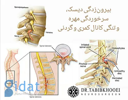 جراحی مغز و اعصاب,جراح مغز و اعصاب در ایران