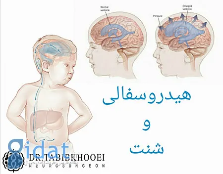 جراحی مغز و اعصاب,جراح مغز و اعصاب در ایران