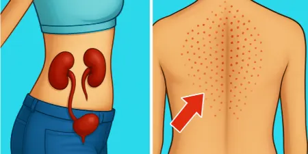 این ۱۷ علامت را نادیده نگیرید؛ سلامت کلیه‌هایتان در خطر است!