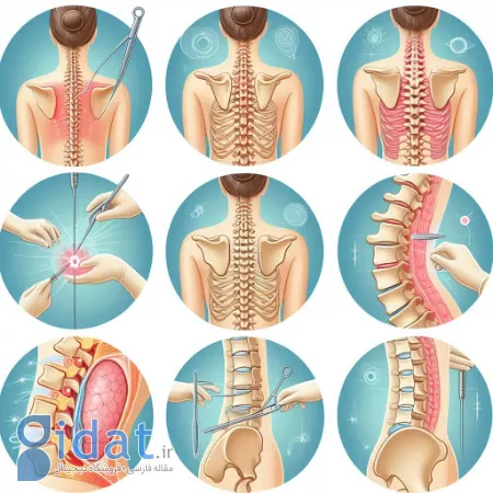 جراحی ستون فقرات, جراحی کم‌تهاجمی ستون فقرات