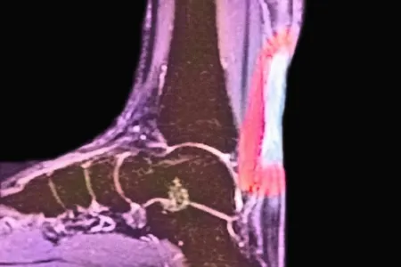 مشکلات رایج پا در افراد مسن, خستگی پا در افراد مسن