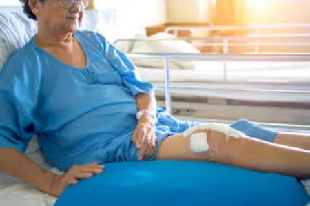 جراحی آرتروز