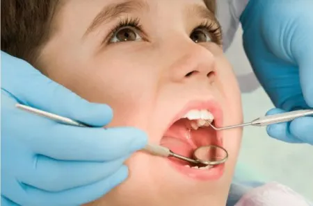 آیا لمینت دندان برای کودکان مضر است؟