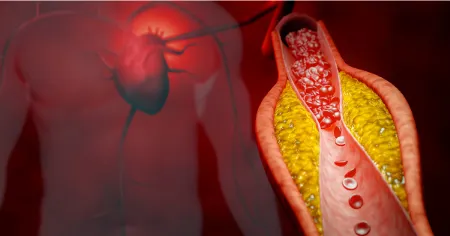 باز کردن رگ قلب, درمان طبیعی تصلب شرایین