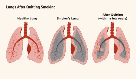 تاثیرات ترک سیگار بر ریه‌ها, علائم بهبود ریه‌ها بعد از ترک سیگار