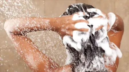 مراقبت از مو