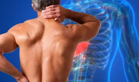 ارتباط گردن درد و کبد چرب, درمان گردن درد