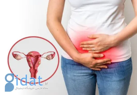 ترکیدن فیبروم رحم, عوارض فیبروم رحمی