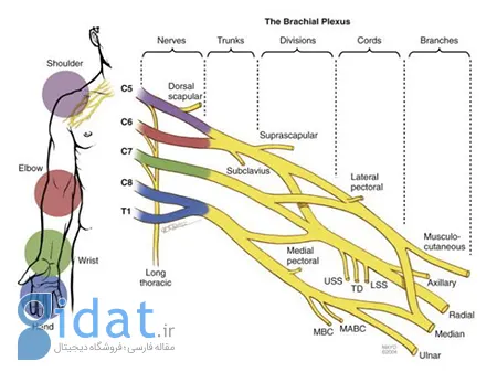 آسیب شبکه بازویی, آسیب شبکه بازویی چیست, شبکه بازویی یا شبکه عصبی براکیال