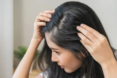 هورمون‌ها و ریزش مو: آیا مشکل از درون بدن است؟