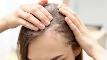 علت درونی ریزش مو چیست