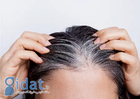 ارتباط بین تیروئید و ریزش مو