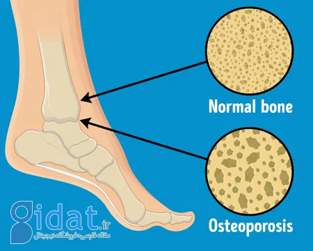  درمان درد مفاصل, درد مفاصل انگشتان دست