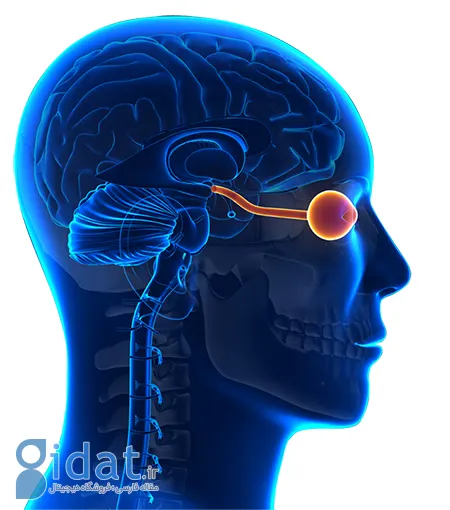 بیماری نورومیلیت اپتیکا, تشخیص نورومیلیت اپتیکا