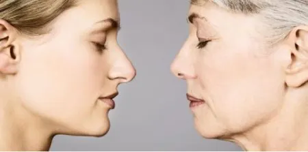کاهش تولید کلاژن و الاستین
