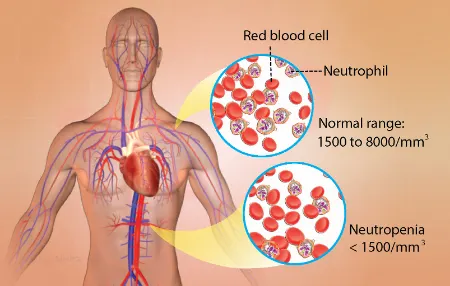 نوتروپنی, علل بروز نوتروپنی, نشانه های نوتروپنی