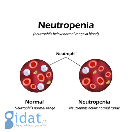 نوتروپنی, علل بروز نوتروپنی, نشانه های نوتروپنی