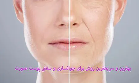 هایفوتراپی بهترین و سریعترین روش برای جوانسازی و سفتی پوست صورت