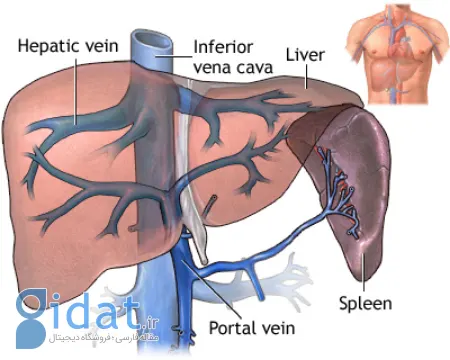ترومبوز ورید کبدی یا سندرم Bud Chiari. تهدیدی خاموش برای سلامت کبد