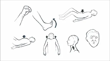 آرام‌سازی پیش‌رونده عضلانی, ریلکسیشن جاکوبسون