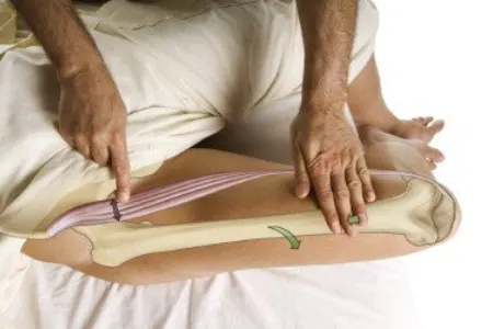 علائم مرالژیا پارستتیکا, علت مرالژیا پارستتیکا