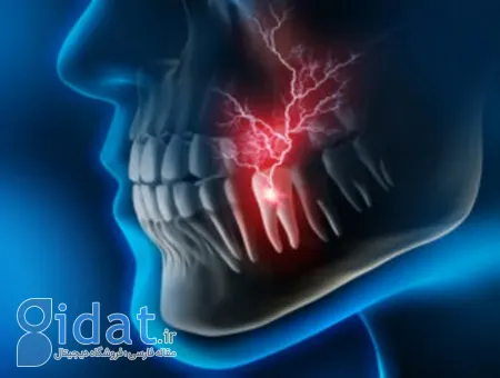 گالوانیسم دهانی, سندروم سوزش دهان