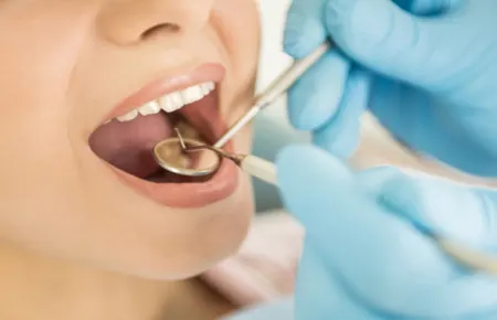 ضرورت انجام معاینات دوره ای دندانپزشکی / پاسخ به سوالات متداول در مورد معاینات دوره ای دندانپزشکی
