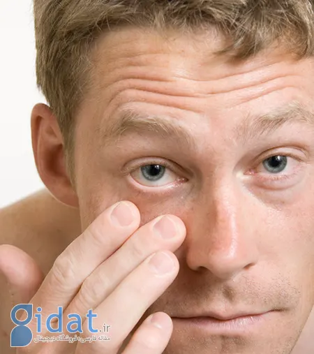 جداشدگی زجاجیه خلفی, تشخیص جداشدگی زجاجیه