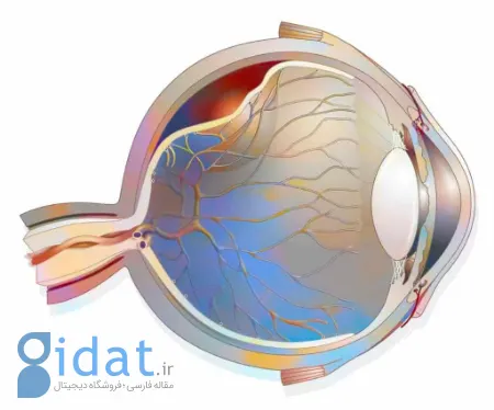 جداشدگی زجاجیه خلفی, تشخیص جداشدگی زجاجیه