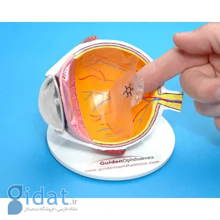 جداشدگی زجاجیه خلفی, تشخیص جداشدگی زجاجیه