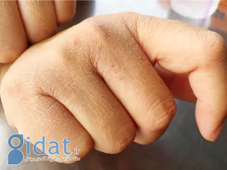 مرطوب‌کننده پوست