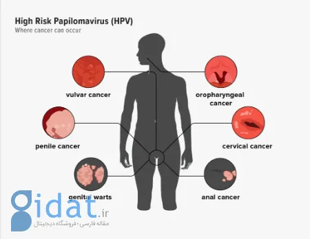 HPV در مردان چیست, خطر HPV برای مردان
