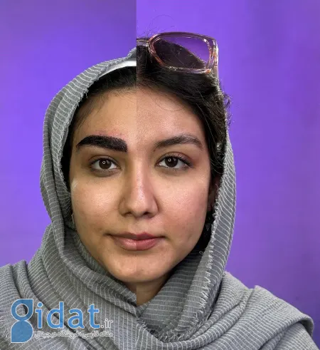 نتیجه نهایی کاشت ابرو