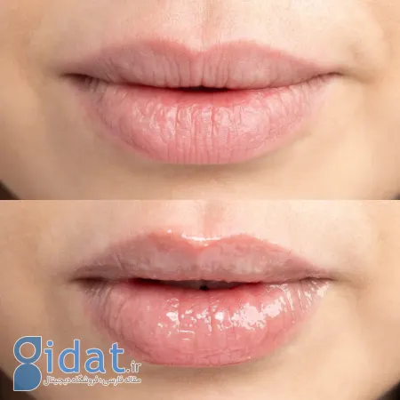 بهترین بالم لب برای پوست خشک؛ یک راهنمای جامع مراقبت
