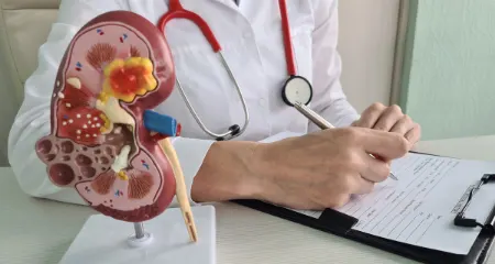 داروهای خطرناک برای کلیه‌ها؛ چگونه از کلیه‌های خود مراقبت کنیم