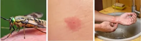 گزیدگی مگس اسب, عفونت گزیدگی مگس اسب