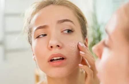 روش‌های خانگی برای پوست خشک