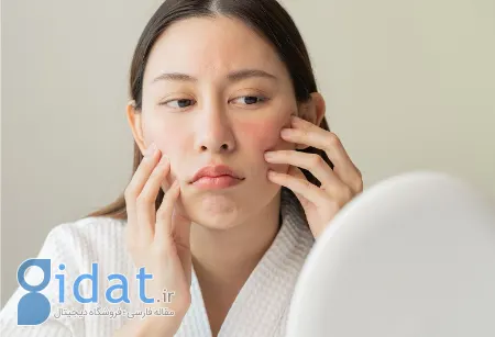 چگونه از پوست خود در برابر تغییرات هورمونی محافظت کنیم؟