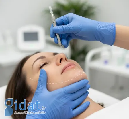 روش انجام لیفت با نخ