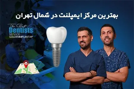 بهترین مرکز ایمپلنت دندان در شمال تهران