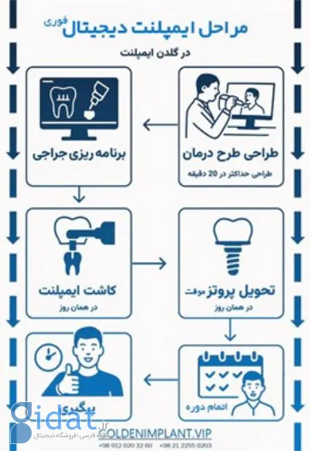 مراحل انجام ایمپلنت در مراکز تخصصی شمال تهران