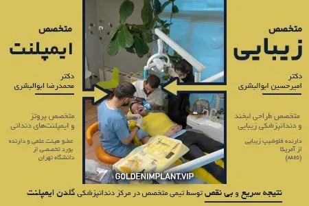 موفقیت ایمپلنت در بهترین مراکز شمال تهران