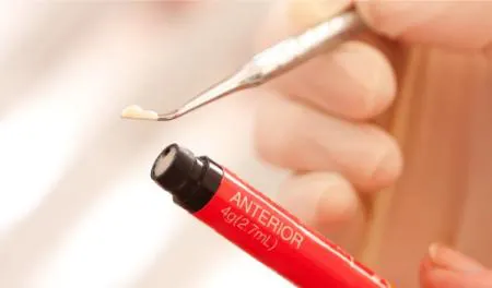 راه‌های درمان عوارض کامپوزیت دندان