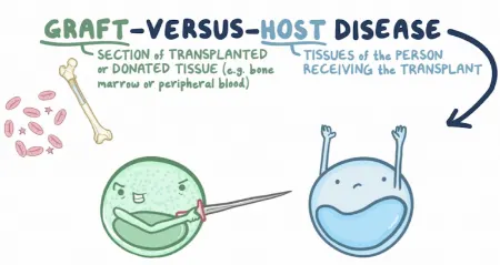 بیماری پیوند در مقابل میزبان, بیماری پیوند علیه میزبان