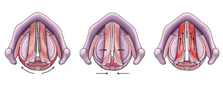 لارینگواسپاسم, اسپاسم حنجره