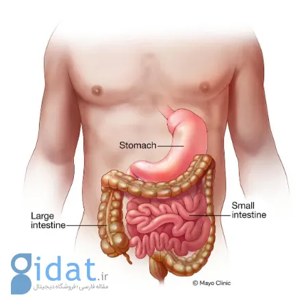 چگونه از ابتلا به ویروس معده پس از قرار گرفتن در معرض آن جلوگیری کنیم؟